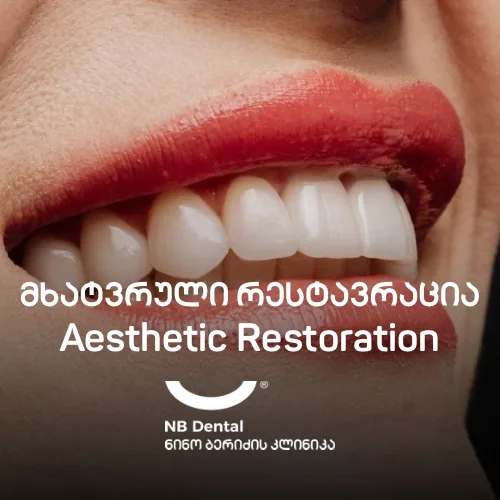 Художественная реставрация зуба в NB Dental