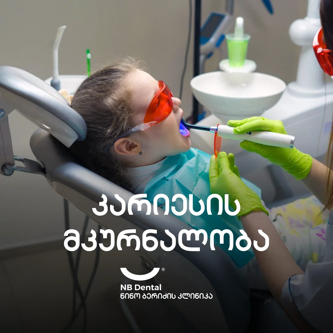 კარიესის მკურნალობა ბავშვებში - NB Dental
