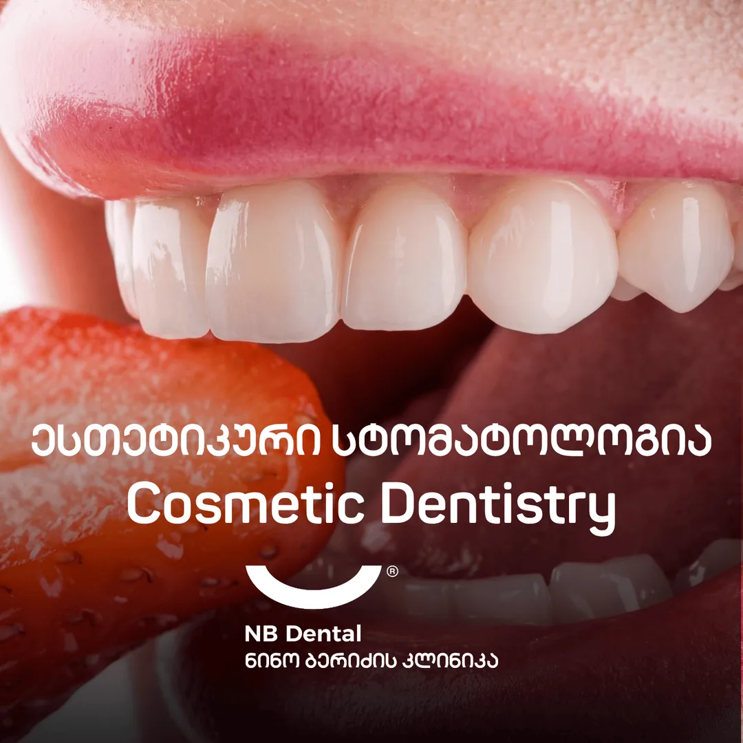 Эстетическая стоматология - виниры в NB Dental