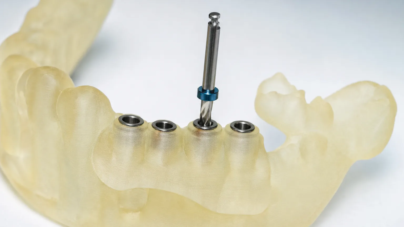 Preparing for dental implant surgery at NB Dental