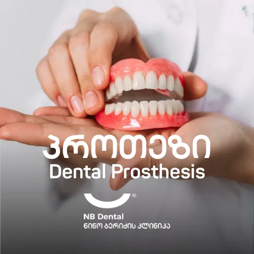 პროთეზი - მოხსნადი კბილის პროთეზირება NB Dental-ში