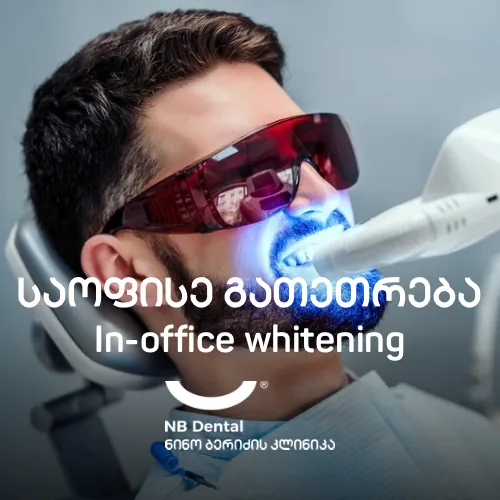 Кабинетное лазерное отбеливание зубов в NB Dental