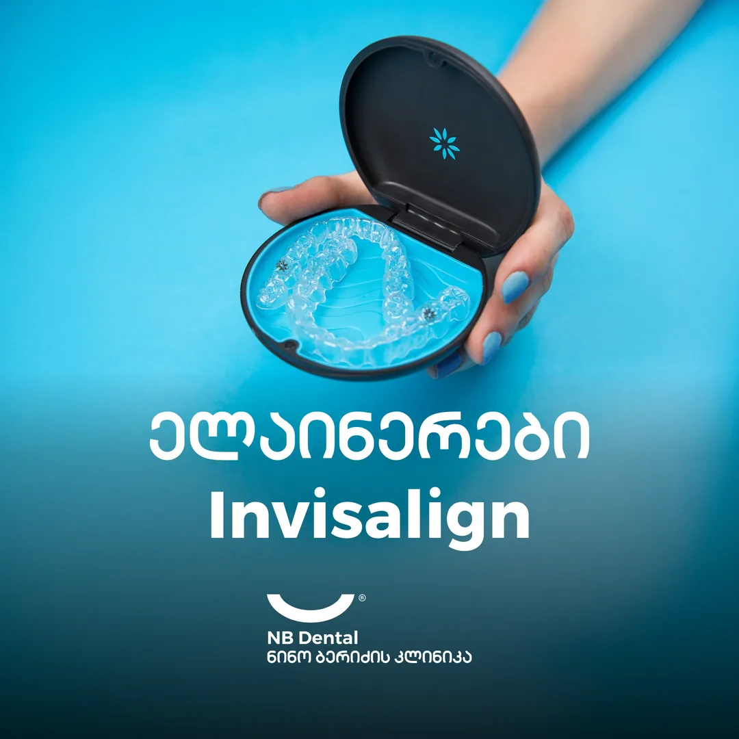 Элайнеры Invisalign - прозрачные каппы в NB Dental