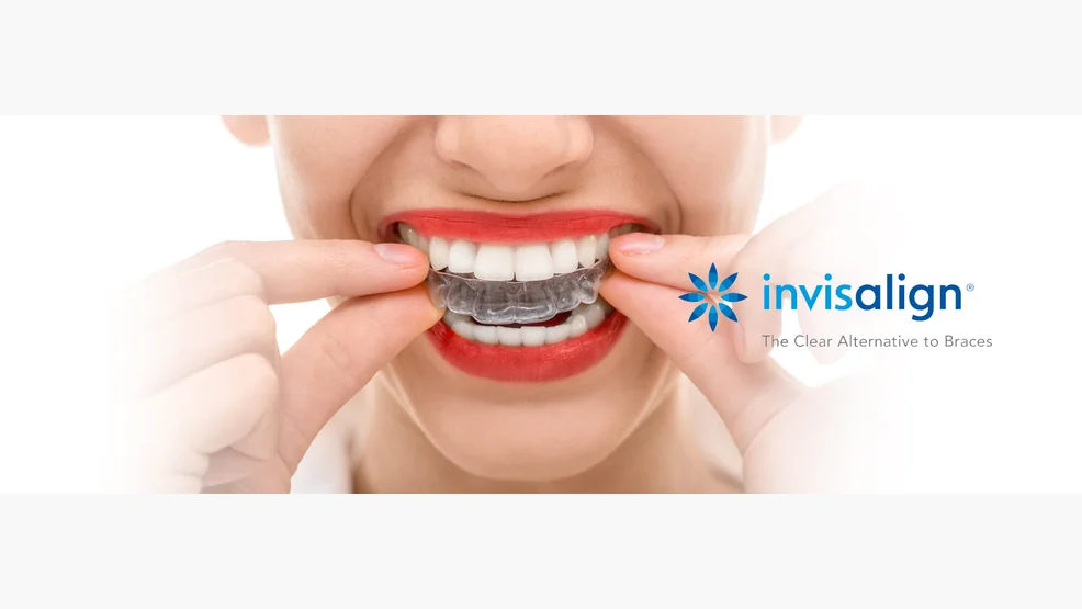 An Invisalign clear aligner on a patient's teeth