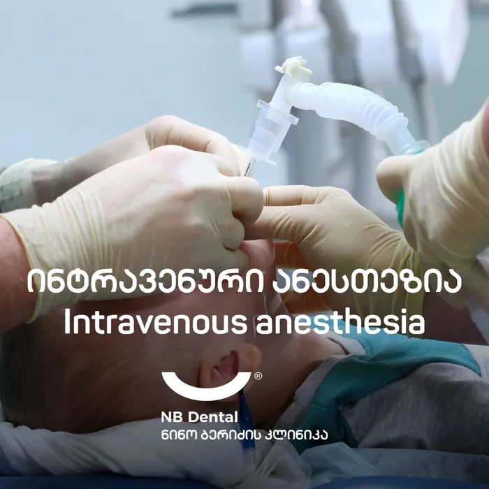 Внутривенная анестезия - седация в NB Dental