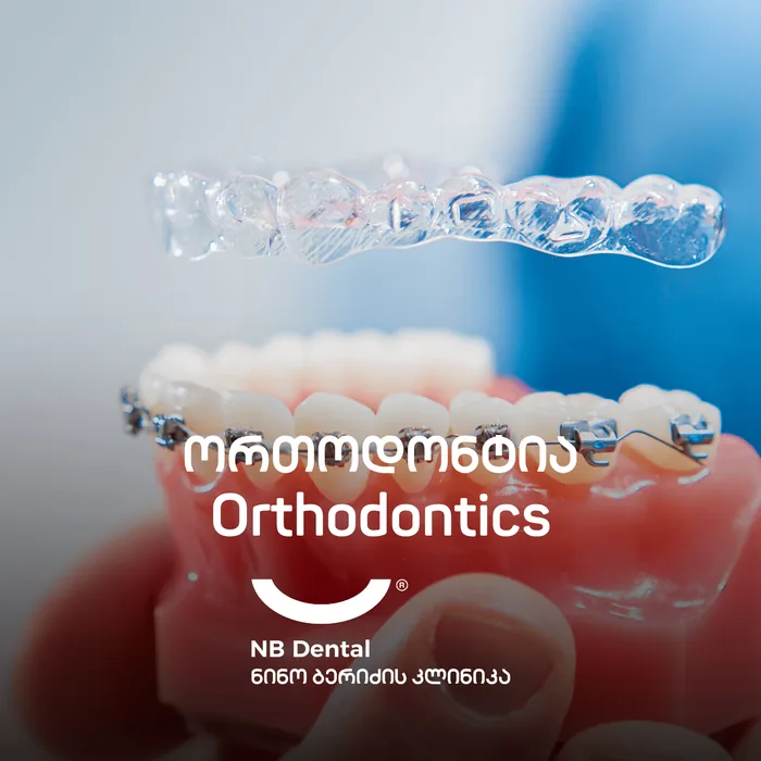 Ортодонтия - брекеты и прозрачные каппы в NB Dental