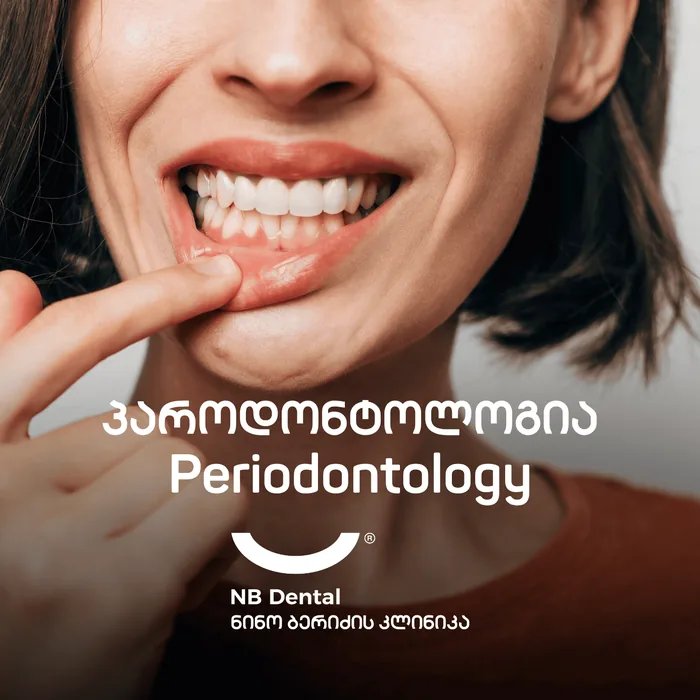Пародонтология - лечение дёсен в NB Dental