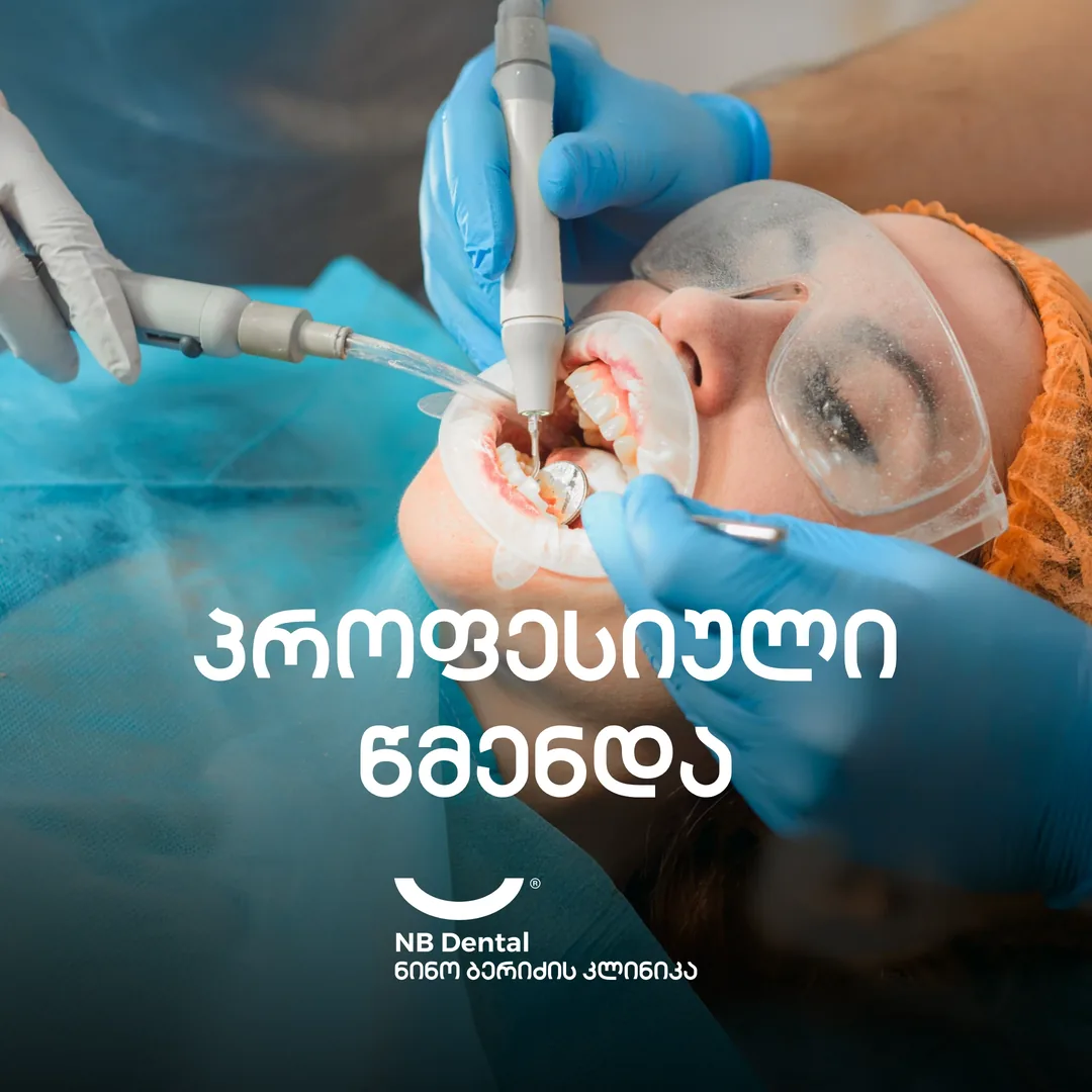 პროფესიული წმენდა - კბილების ჰიგიენა NB Dental-ში