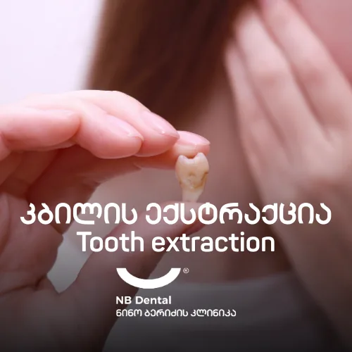 Удаление зуба в NB Dental