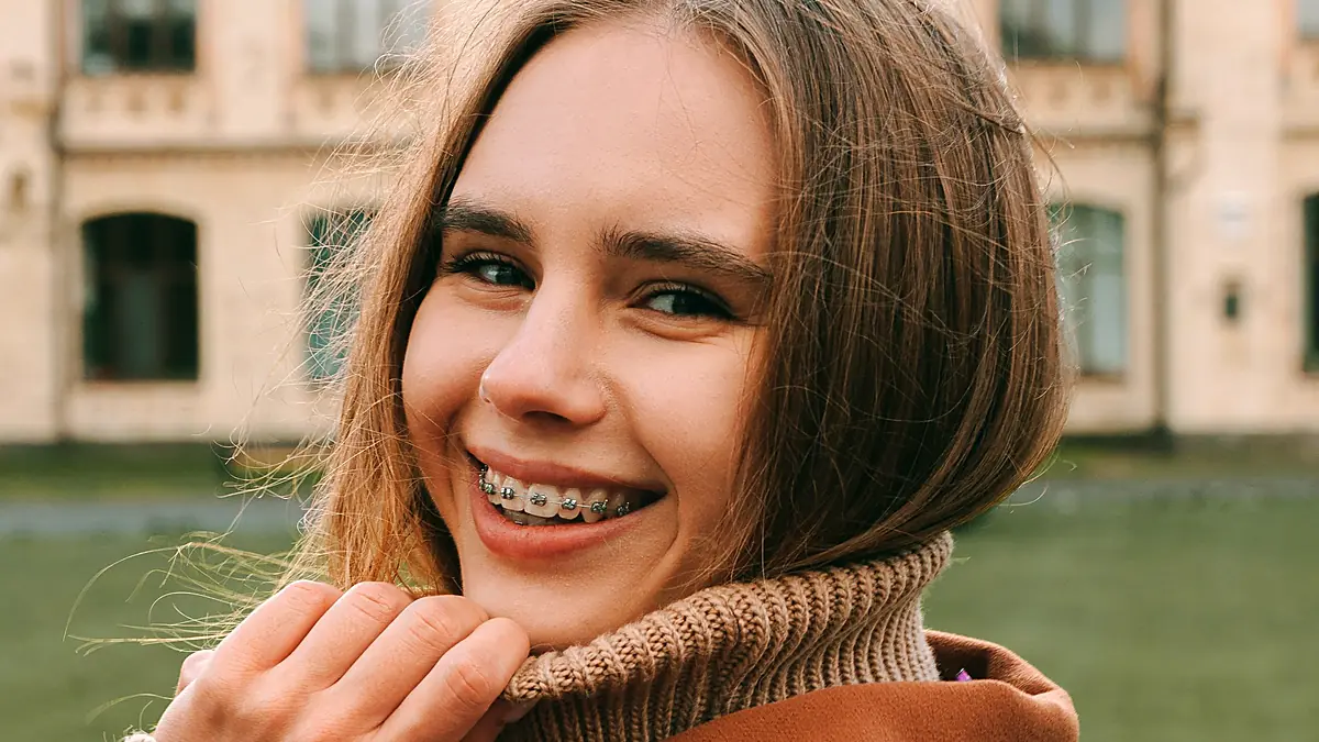 ბრეკეტებით კბილების გასწორება NB Dental-ში