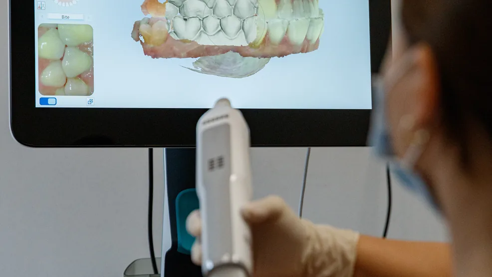 Цифровое сканирование зубов и трёхмерное изображение в NB Dental